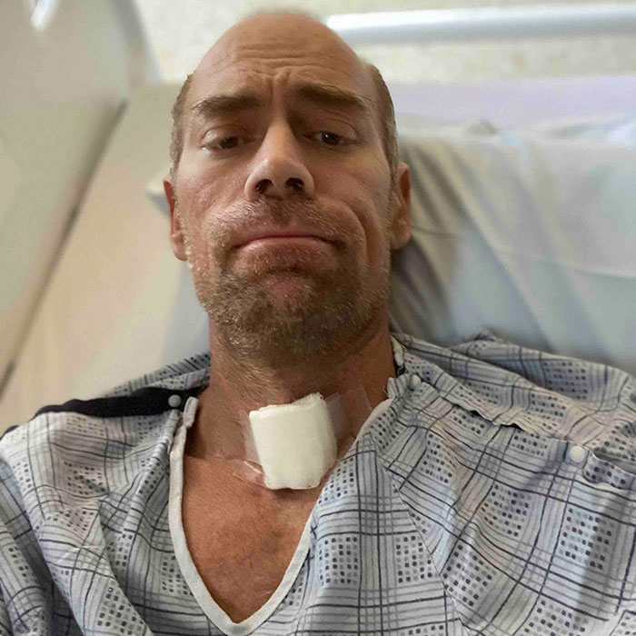 Man Shares An Eye-Opening Pic Showing What Covid-19 Did To Him After 6 Weeks In A Hospital