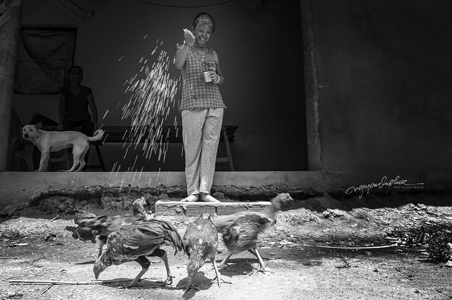 Abandoned Child Faces Gloomy Future Because Of Acid Attack Abandoned Child Faces Gloomy Future Because Of Acid Attack