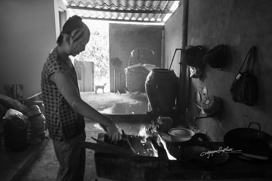 Abandoned Child Faces Gloomy Future Because Of Acid Attack