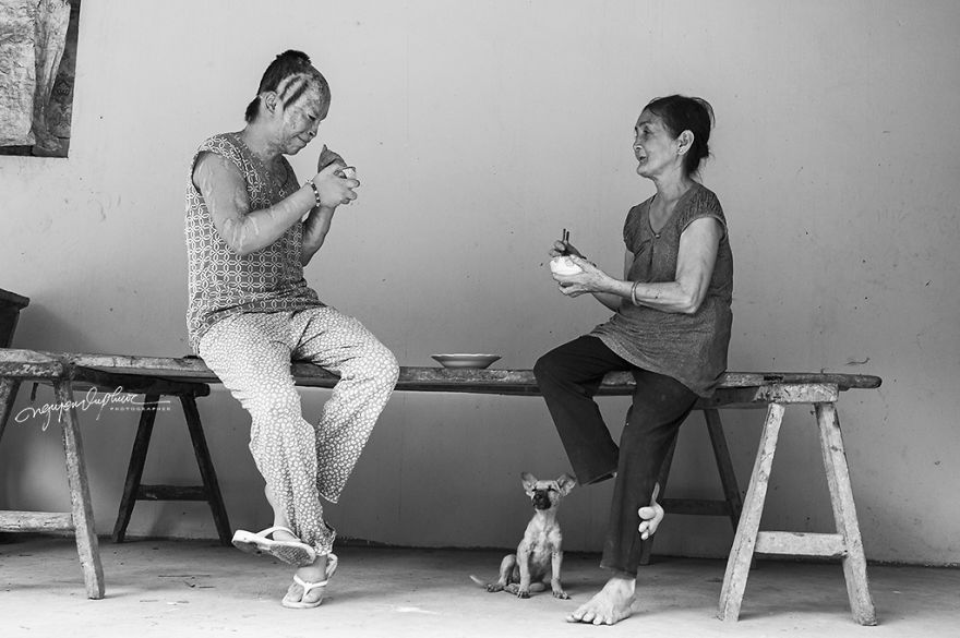 Abandoned Child Faces Gloomy Future Because Of Acid Attack Abandoned Child Faces Gloomy Future Because Of Acid Attack