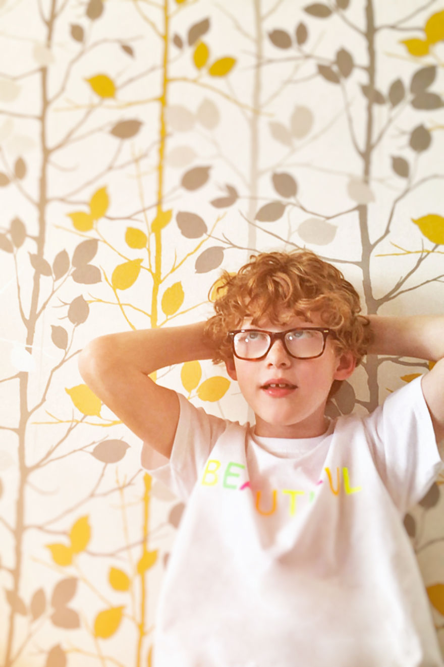 Models With Disabilities And Visbible Differences Take Part In Unique Photoshoots At Home. Project Isolation.