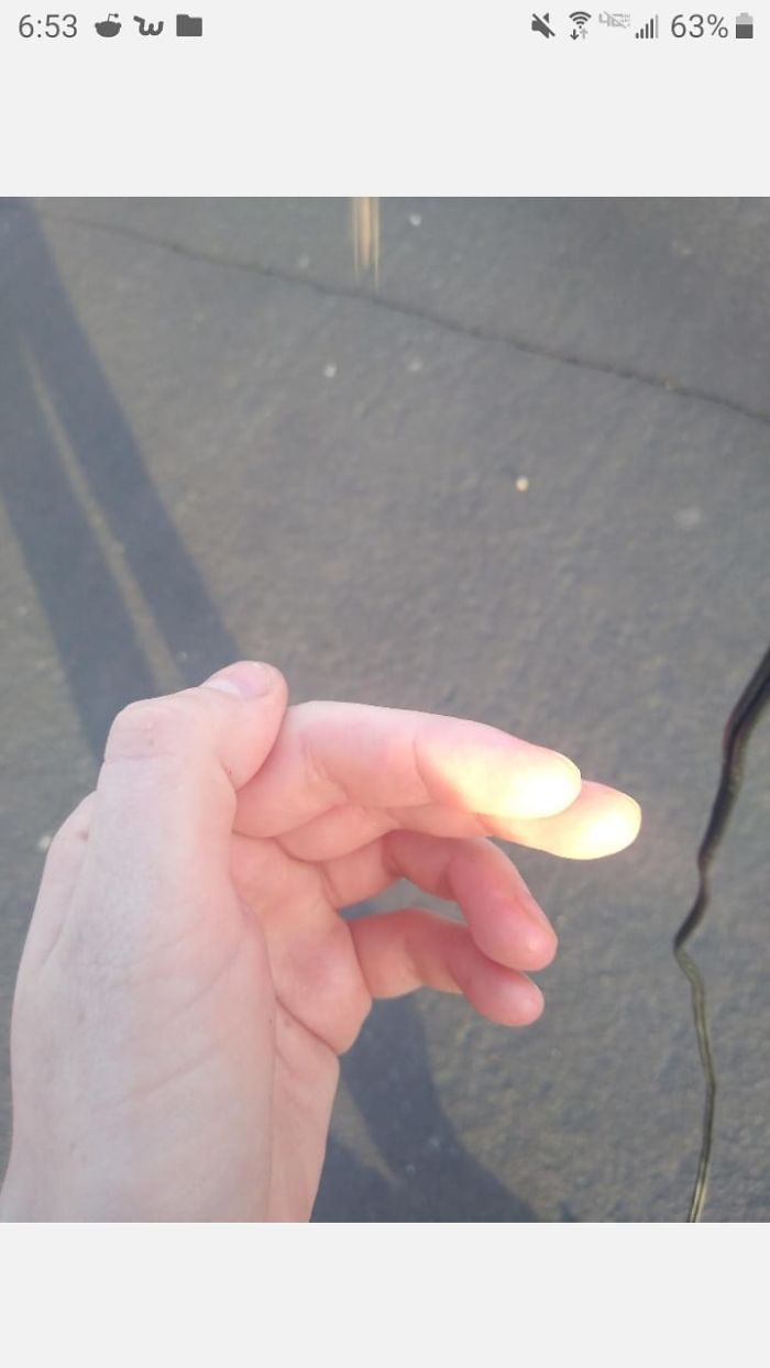 My Daughter Sent Me This Picture Of A Tiny Grasshopper. I Mean, Those Little Leggies...