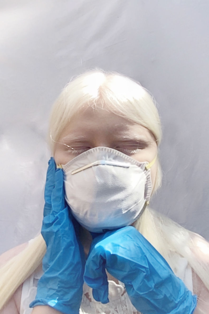 Models With Disabilities And Visbible Differences Take Part In Unique Photoshoots At Home. Project Isolation.