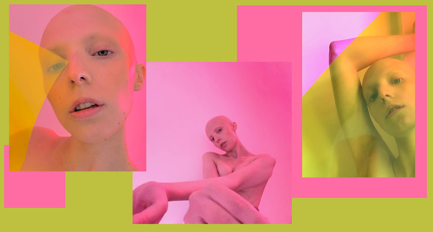 Models With Disabilities And Visbible Differences Take Part In Unique Photoshoots At Home. Project Isolation.