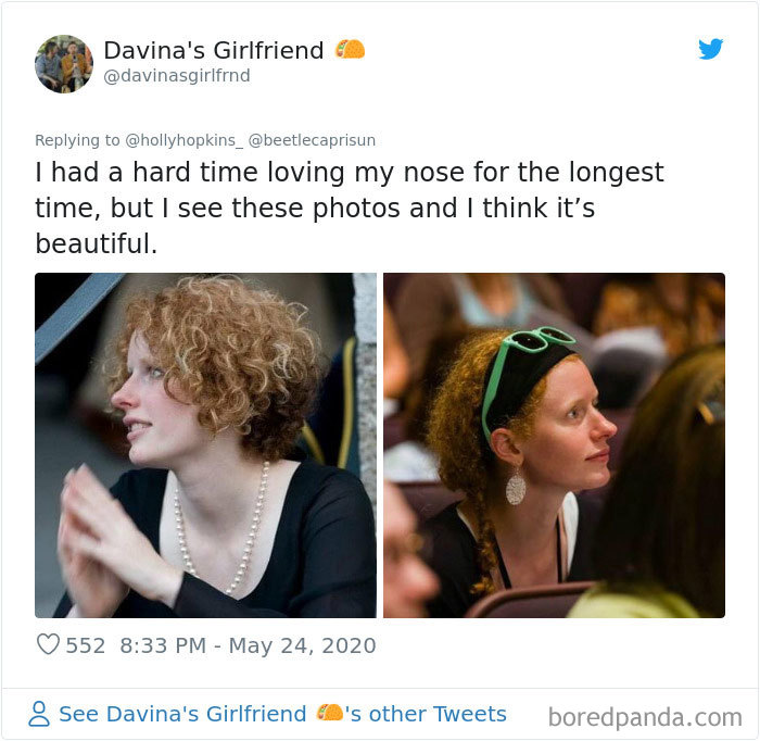 Noses-Look-Like-Before-Photos