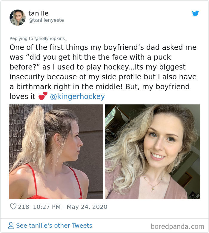 Noses-Look-Like-Before-Photos