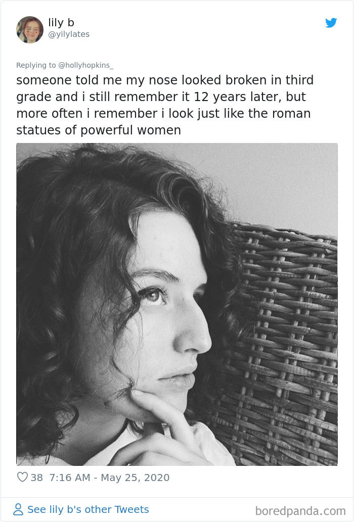 Noses-Look-Like-Before-Photos