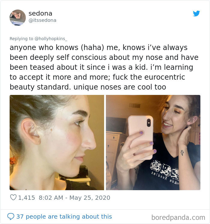 Noses-Look-Like-Before-Photos