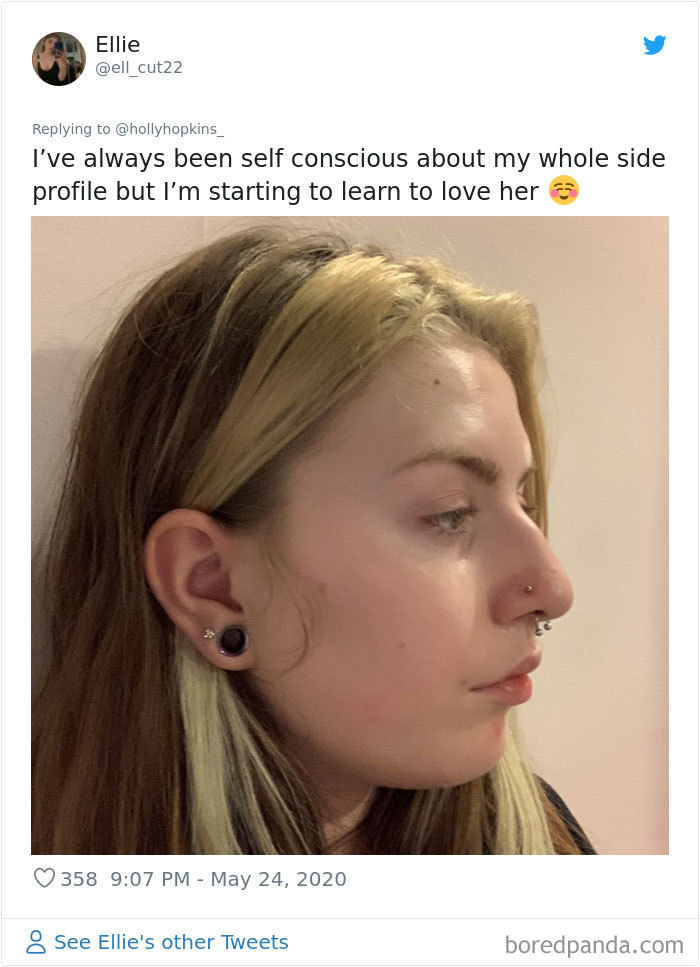 Noses-Look-Like-Before-Photos