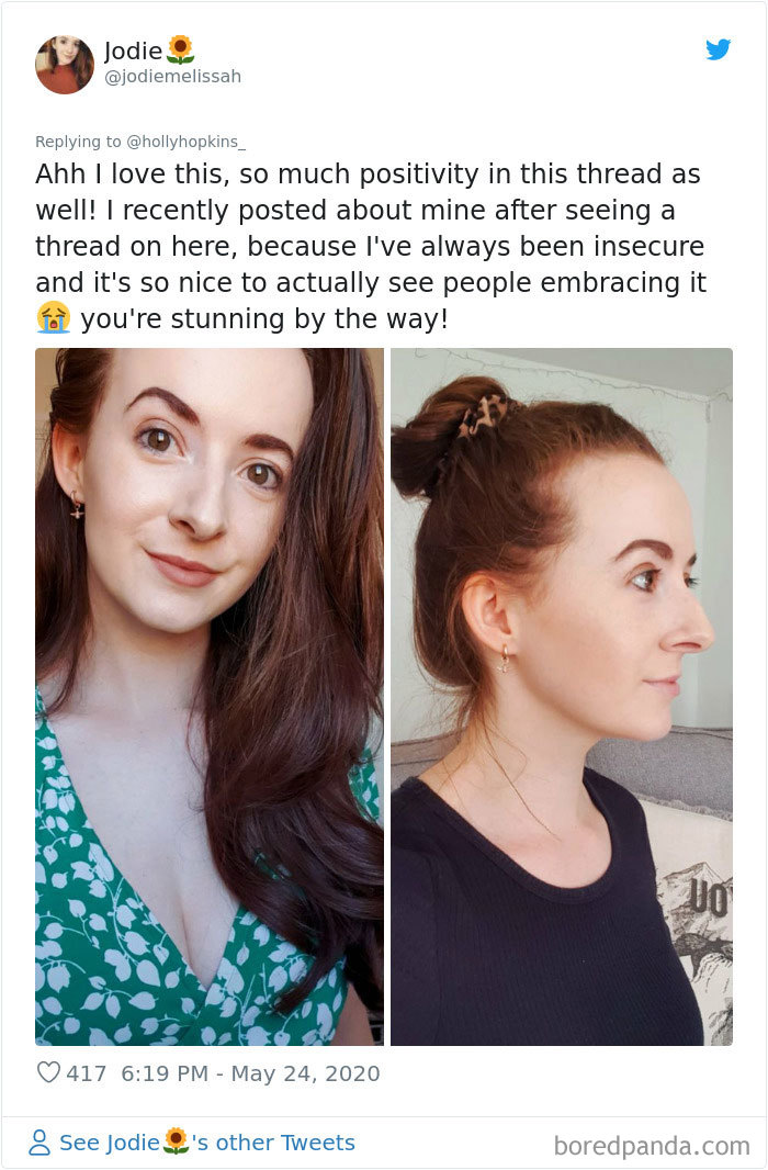 Noses-Look-Like-Before-Photos