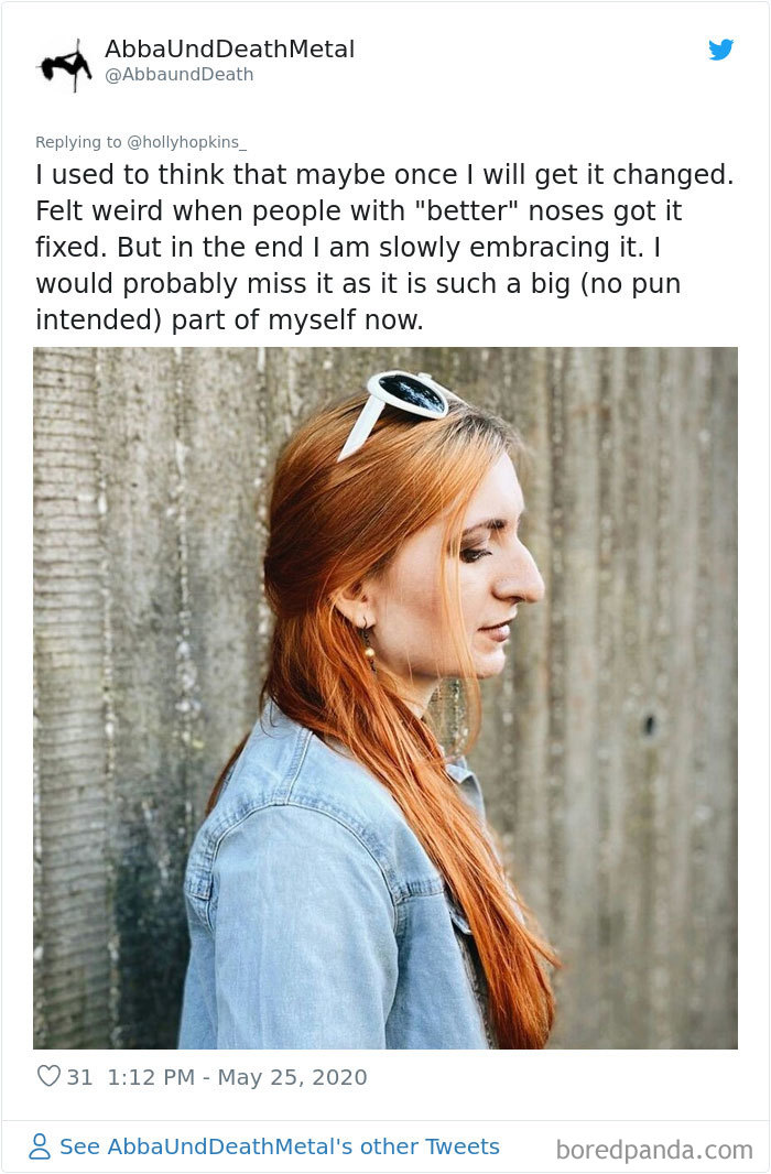 Noses-Look-Like-Before-Photos