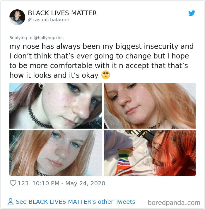 Noses-Look-Like-Before-Photos