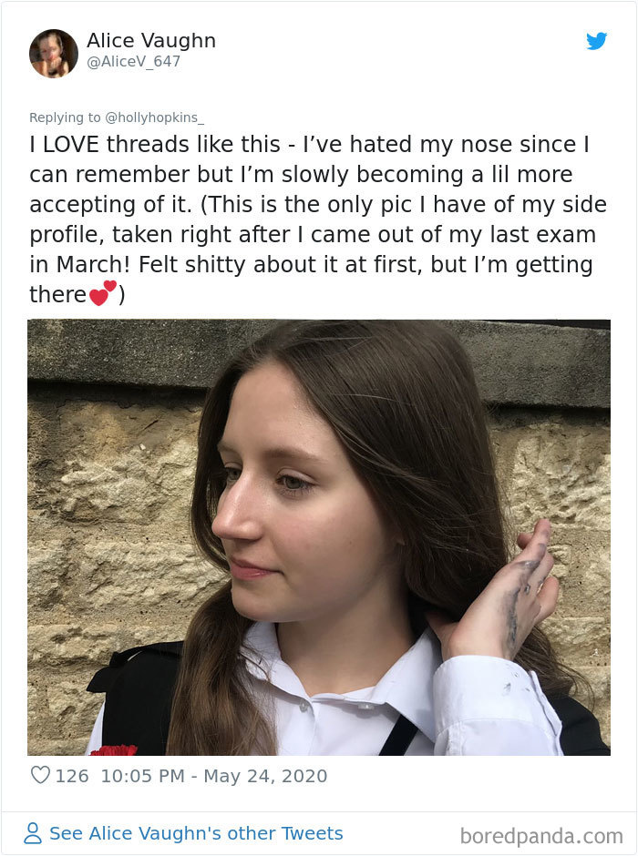 Noses-Look-Like-Before-Photos