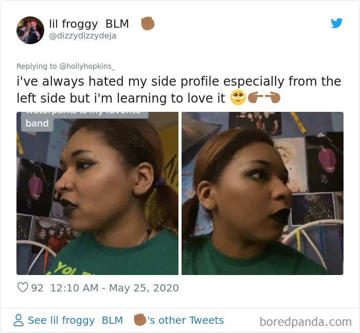 Noses-Look-Like-Before-Photos