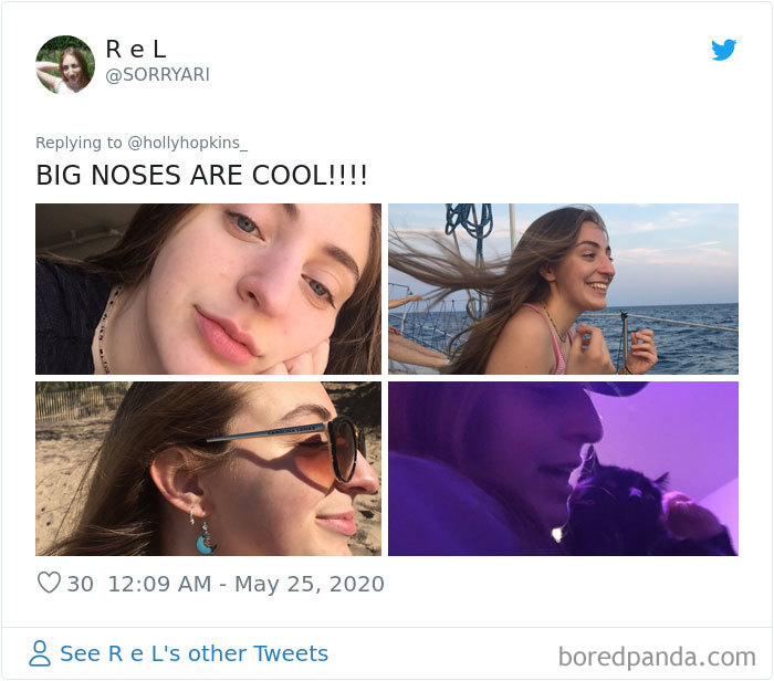 Noses-Look-Like-Before-Photos