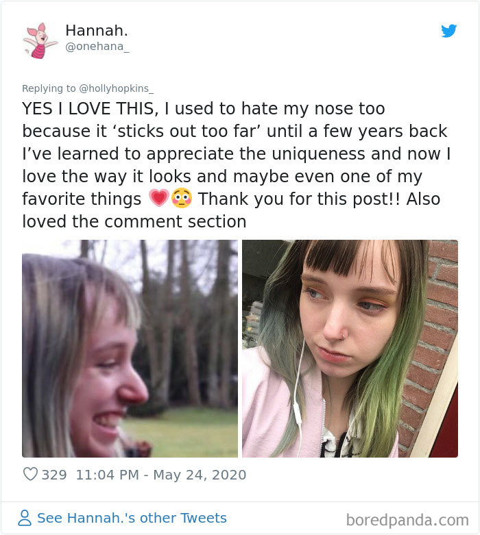 Noses-Look-Like-Before-Photos