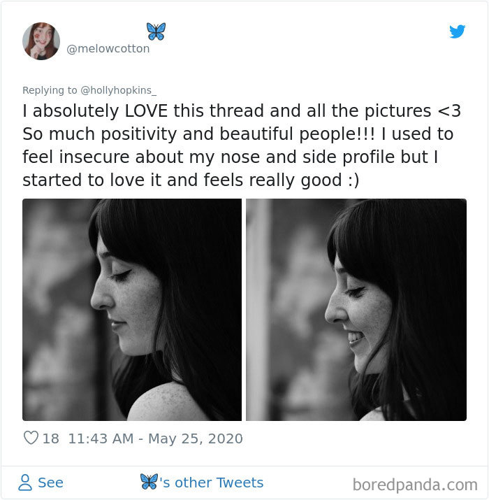 Noses-Look-Like-Before-Photos