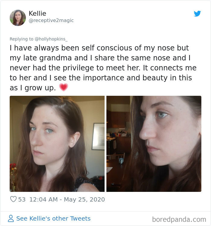 Noses-Look-Like-Before-Photos