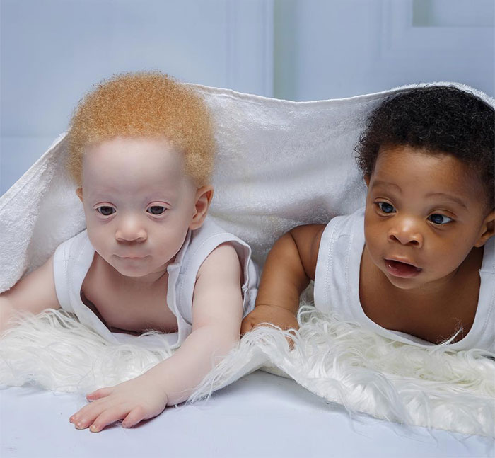 Mom Of Black And White Twins Often Gets Asked Which One Of The Boys Is Hers