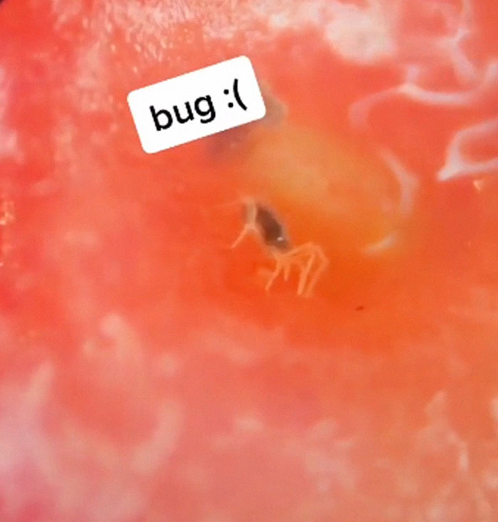 Apparently, If You Put Strawberries Into Salt Water, Tiny Bugs Come Out Of Them