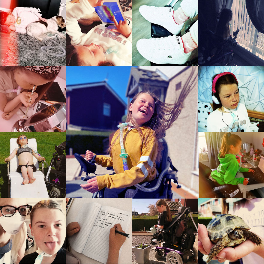 Models With Disabilities And Visbible Differences Take Part In Unique Photoshoots At Home. Project Isolation. Models With Disabilities And Visbible Differences Take Part In Unique Photoshoots At Home. Project Isolation.