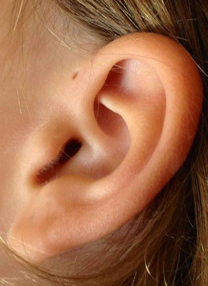 People Are Realizing That Those Tiny Holes Above Their Ears May Have An Evolutionary Explanation People Are Realizing That Those Tiny Holes Above Their Ears May Have An Evolutionary Explanation