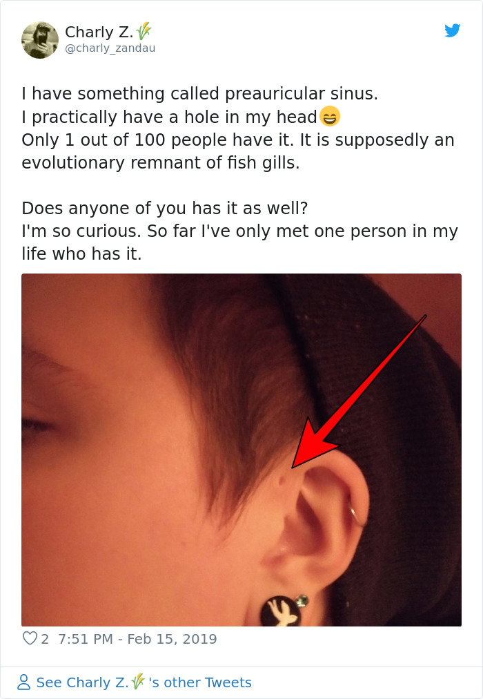 People Are Realizing That Those Tiny Holes Above Their Ears May Have An Evolutionary Explanation People Are Realizing That Those Tiny Holes Above Their Ears May Have An Evolutionary Explanation