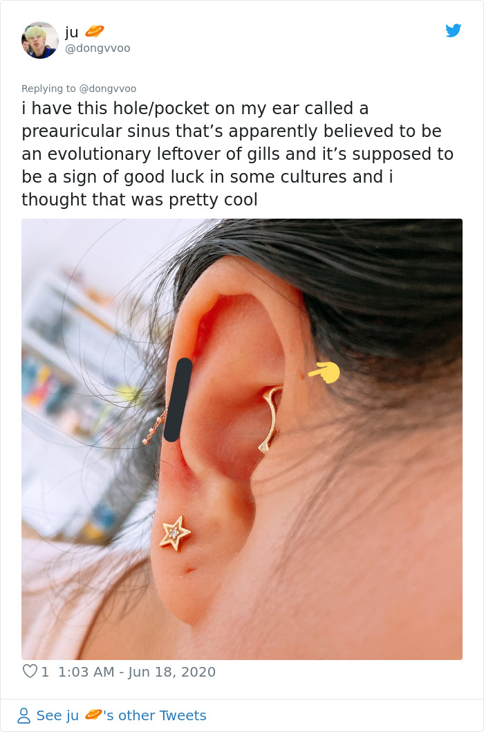 People Are Realizing That Those Tiny Holes Above Their Ears May Have An Evolutionary Explanation People Are Realizing That Those Tiny Holes Above Their Ears May Have An Evolutionary Explanation