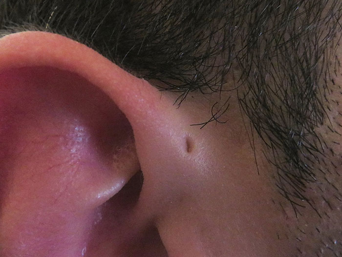 People Are Realizing That Those Tiny Holes Above Their Ears May Have An Evolutionary Explanation People Are Realizing That Those Tiny Holes Above Their Ears May Have An Evolutionary Explanation