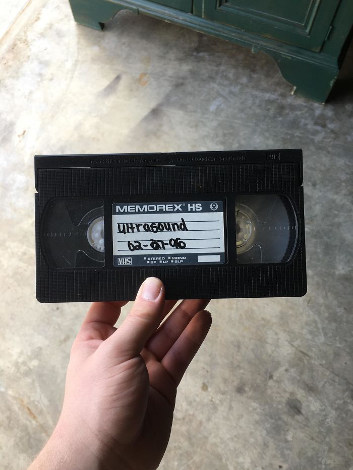 The Tape That Had My Mom’s First Ultrasound Of Me, Until I Taped Reruns Of The Simpsons Over It When I Was 7