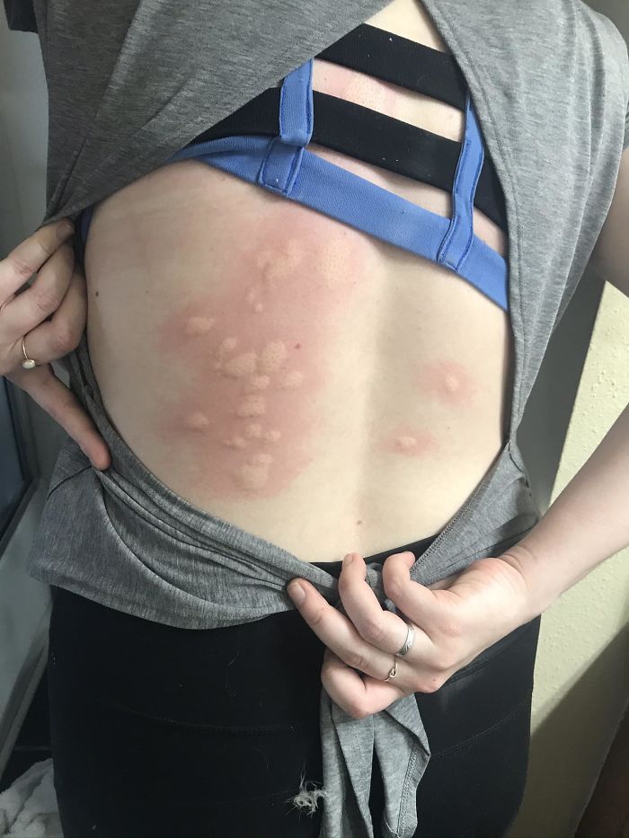 Mosquitos Just Love Open Back Shirts