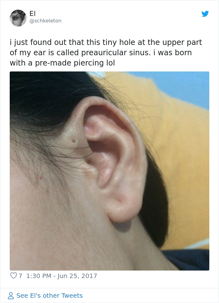 People Are Realizing That Those Tiny Holes Above Their Ears May Have An Evolutionary Explanation