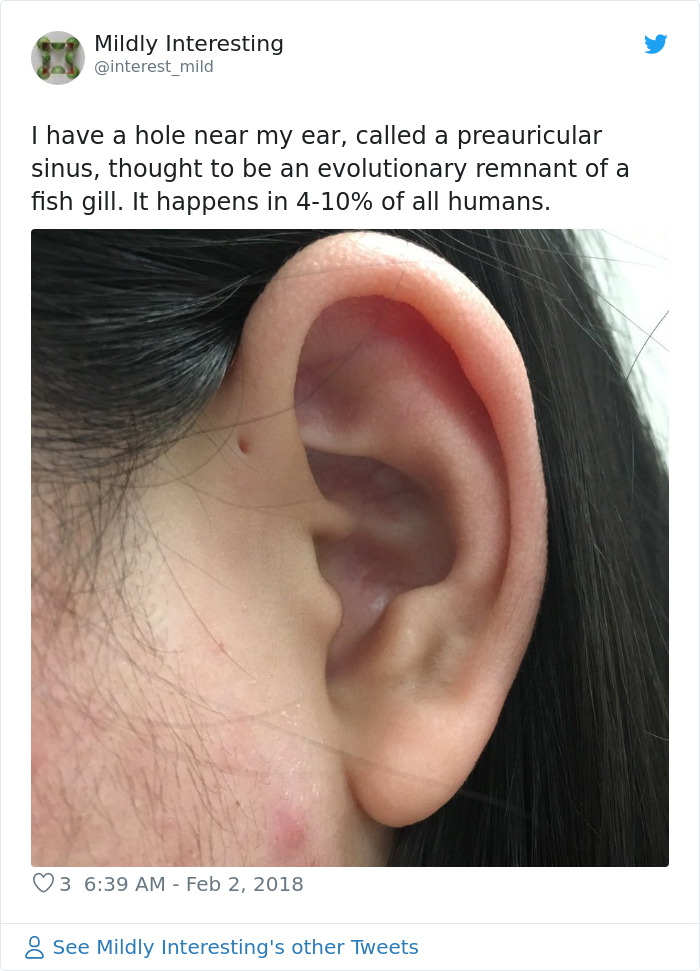 People Are Realizing That Those Tiny Holes Above Their Ears May Have An Evolutionary Explanation People Are Realizing That Those Tiny Holes Above Their Ears May Have An Evolutionary Explanation