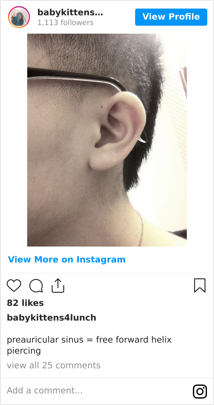 People Are Realizing That Those Tiny Holes Above Their Ears May Have An Evolutionary Explanation