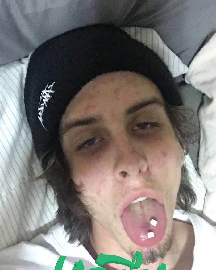 Guy Shares Pics Before And 745 Days After Quitting Drugs And The Transformation Is Incredible