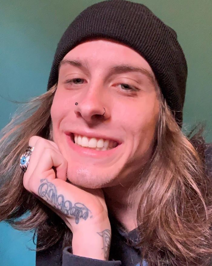 Guy Shares Pics Before And 745 Days After Quitting Drugs And The Transformation Is Incredible Guy Shares Pics Before And 745 Days After Quitting Drugs And The Transformation Is Incredible