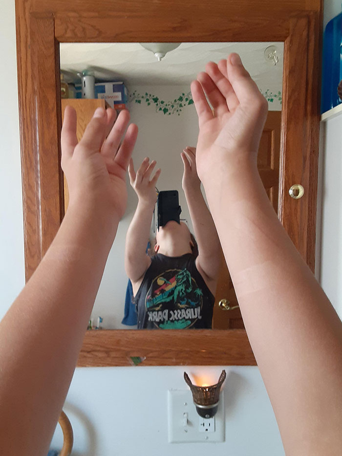 I Got Band-Aid Tan Lines