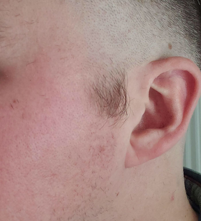 To Anyone Out Getting A Haircut Over The Next Few Weeks. Make Sure They Get Under The Mask/Straps