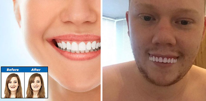 Don't Buy Veneers Online
