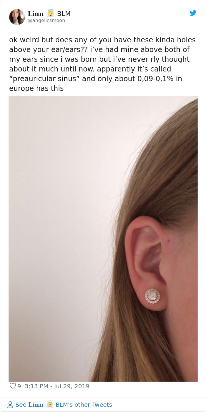 People Are Realizing That Those Tiny Holes Above Their Ears May Have An Evolutionary Explanation People Are Realizing That Those Tiny Holes Above Their Ears May Have An Evolutionary Explanation