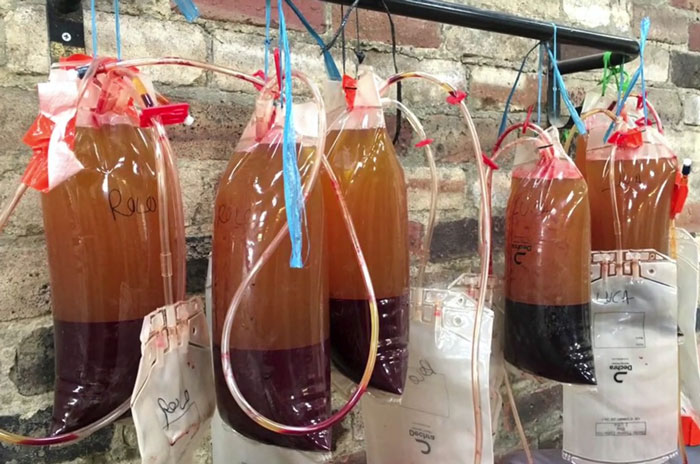 Volunteers 'Shocked' To See This 'Dead' Horse Still Alive Nurse It Back To Health And The Transformation Is Incredible