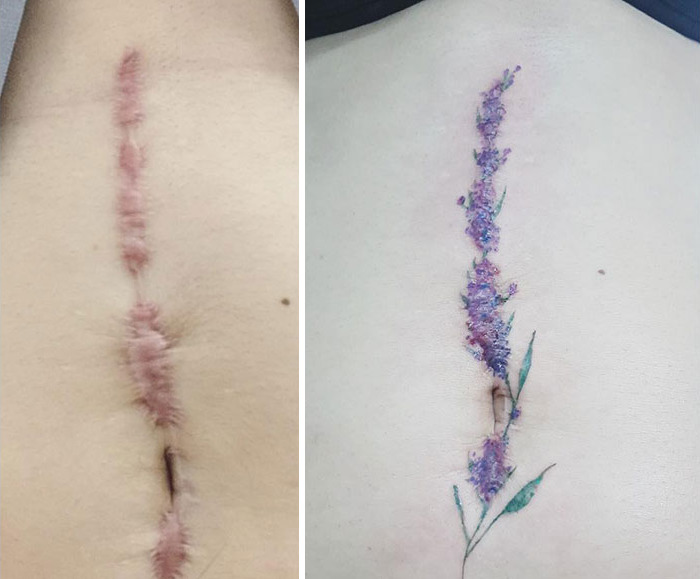 Tattoo artist covers a vertical scar with a floral tattoo transformation.