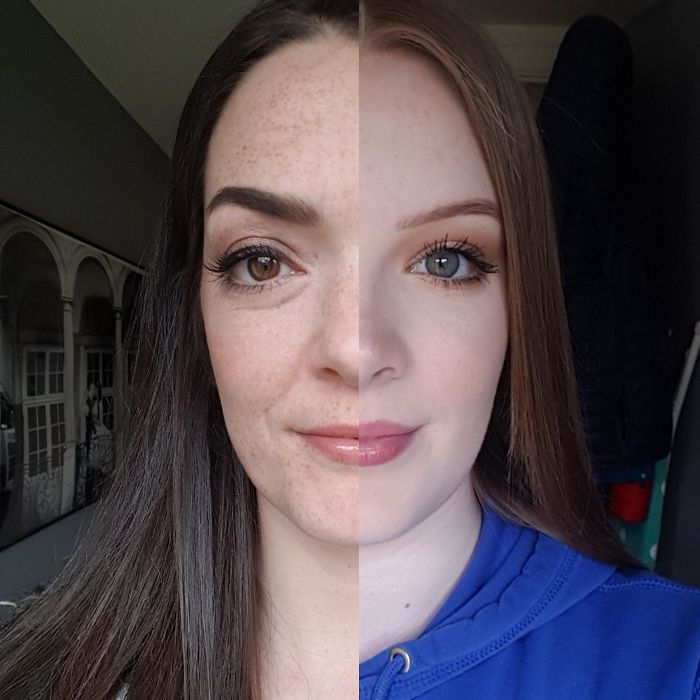 5 Years On, Half Face Comparison Of Me And My Daughter