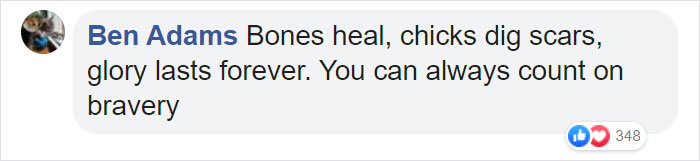6-Year-Old Superhero Saves Sister From Dog Attack, Gets 90 Stitches And Praise From The Avengers 6-Year-Old Superhero Saves Sister From Dog Attack, Gets 90 Stitches And Praise From The Avengers