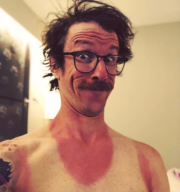 Eah. Nice And Sunny Day! That’s How You Look After A 4h 35 Min. Run In The Sun