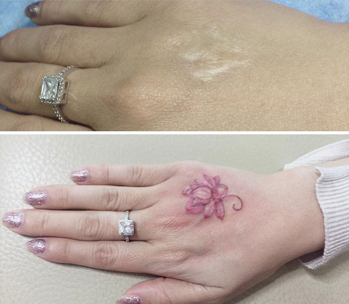 Tattoo covering a scar with a floral design on a hand, transforming the appearance beautifully.