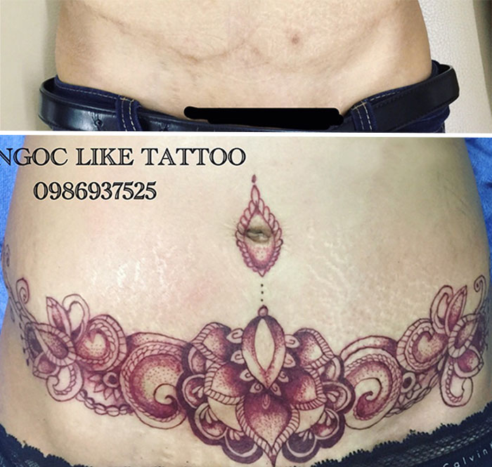 Tattoo Artist Makes Real Works Of Art Covering Sad Scars