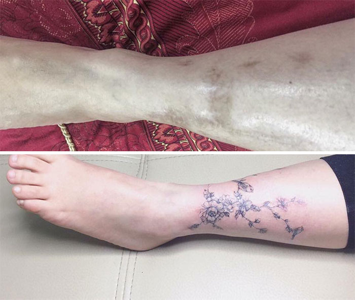 Tattoo Artist Makes Real Works Of Art Covering Sad Scars