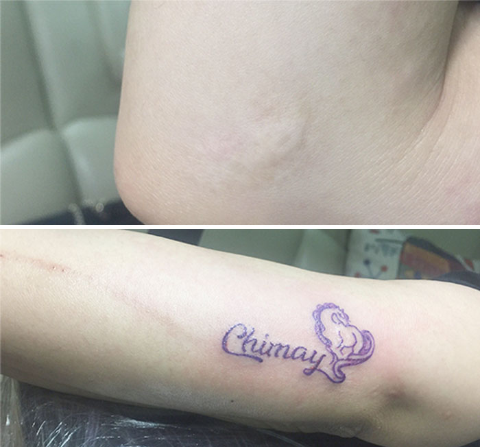 Tattoo Artist Makes Real Works Of Art Covering Sad Scars
