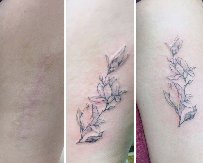 Tattoo Artist Makes Real Works Of Art Covering Sad Scars